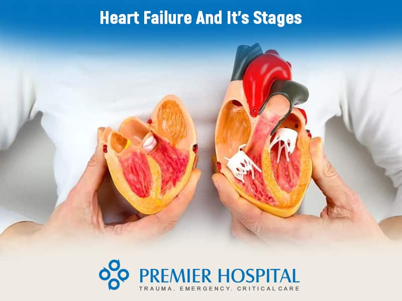 Heart Failure And It’s Stages