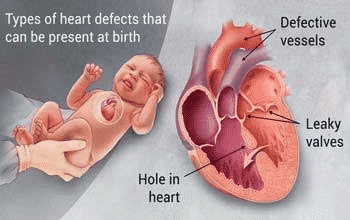 How Do I Know If My Child Has Heart Problems?