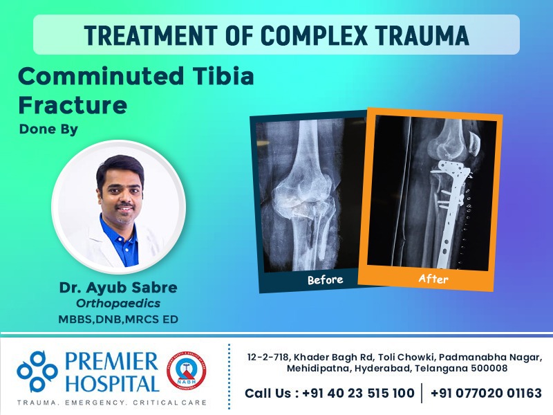 Tibia Fracture Case Study