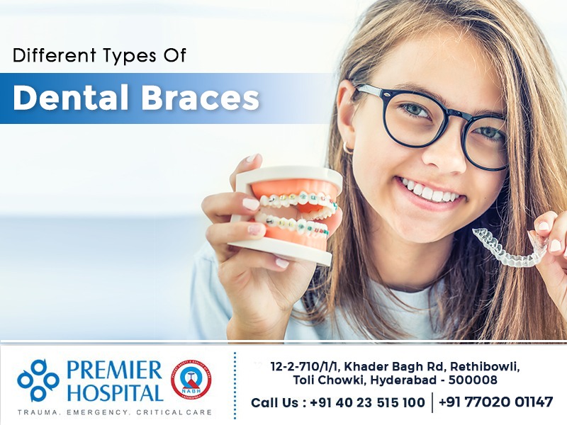 Different Types of Dental Braces