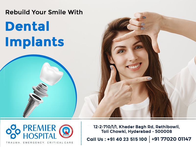 Rebuild Your Beautiful Smile With Dental Implants