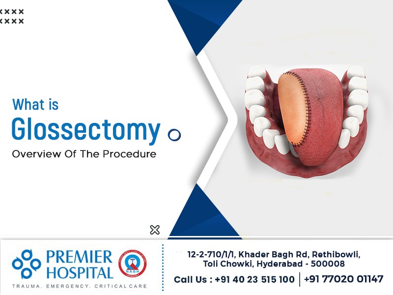 What is Glossectomy ? Overview of the procedure