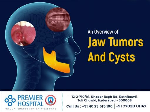 An Overview Of Jaw Tumors And Cysts Premier Hospital 0187