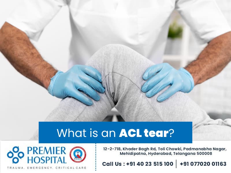 What is an ACL tear